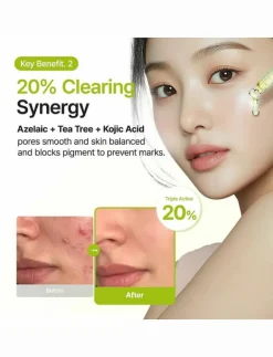 Azelaic Acid 10 Kojic Tea Tree Serum - Serum