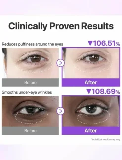 No.9 NAD Under Eye Patches - Ögonmask